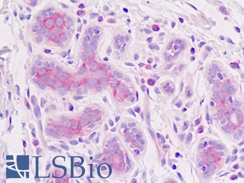 IHC-plus™ Polyclonal Rabbit anti-Human EIF3E Antibody (IHC, WB)