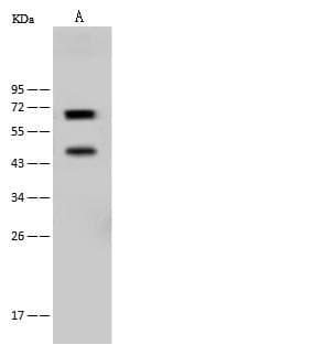 NF2 / Merlin Antibody (Preservative Free)