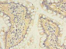 SULT1B1 / Sulfotransferase 1B1 Antibody (aa1-271)