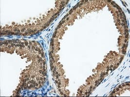 ACAT2 Antibody (clone OTI3A11, Carrier-free)