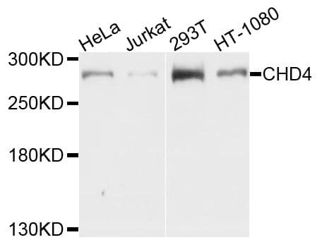 Polyclonal Rabbit anti-Human CHD4 Antibody (WB)