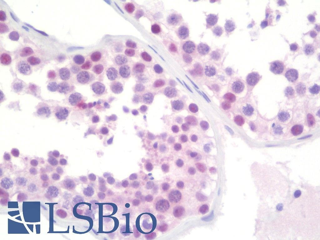 IHC-plus™ TRMT2A Antibody (clone 1G8)