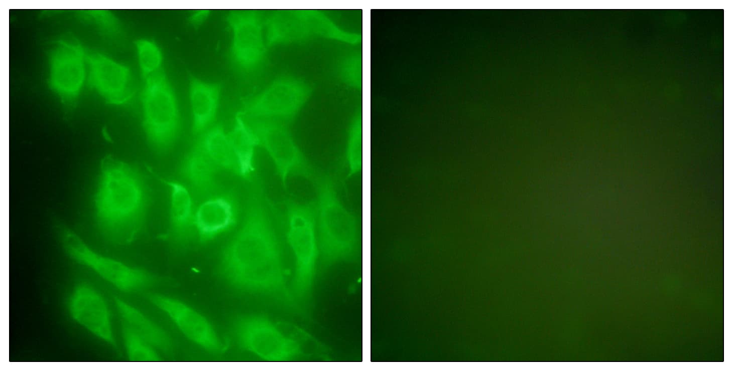 IHC-plus™ HSP90AA1 / Hsp90 Alpha A1 Antibody (aa683-732)