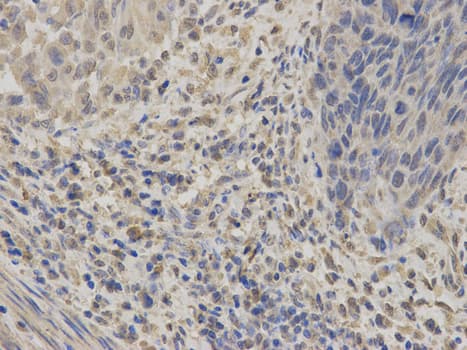 Polyclonal Rabbit anti-Human GABRA2 Antibody (IHC, WB)