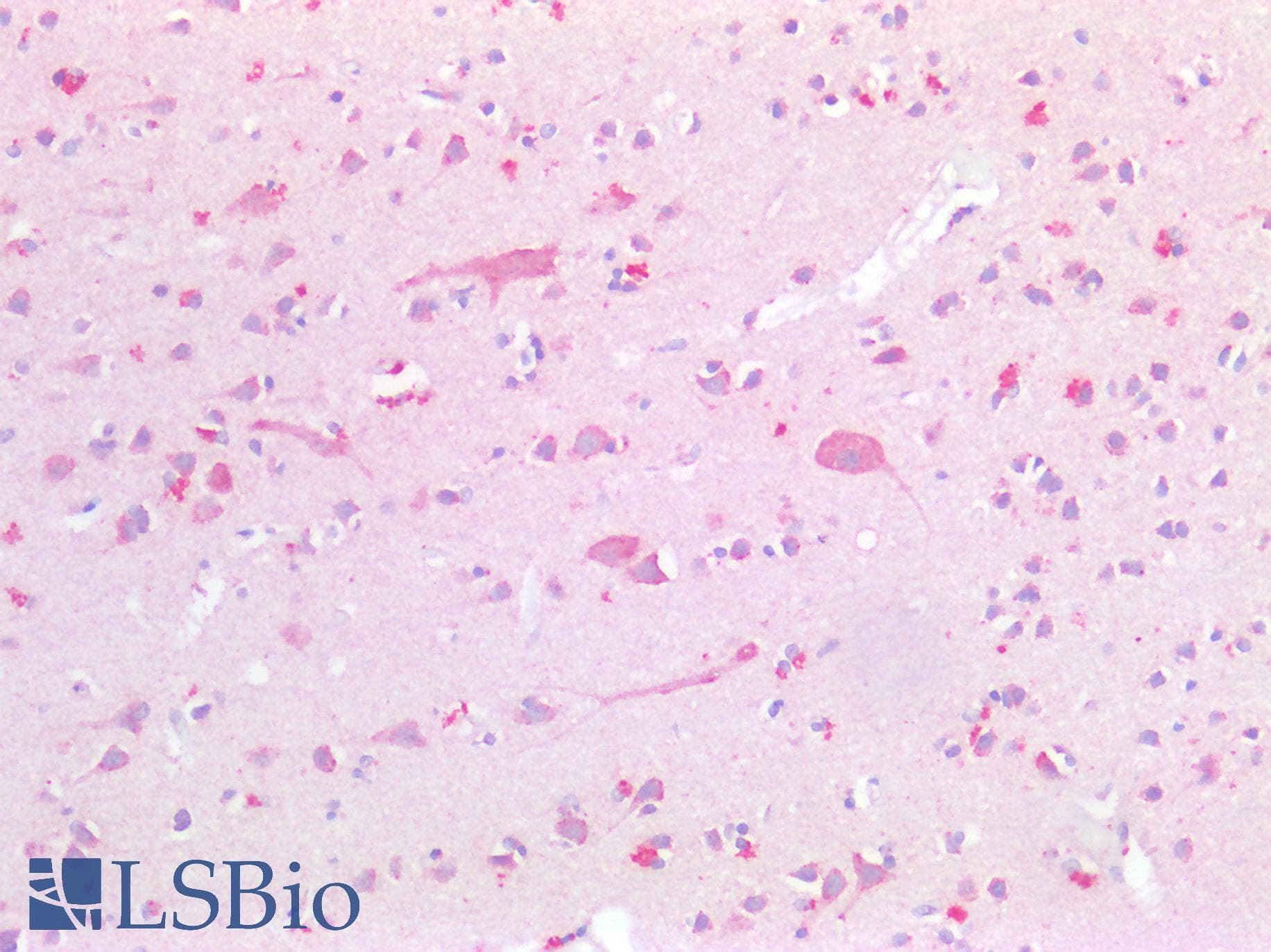 IHC-plus™ Osteonectin / SPARC Antibody