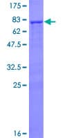 Human SMOC1 Protein (Recombinant GST)