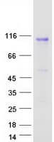 Human IL17RD Protein (Recombinant Myc-DDK (Flag))