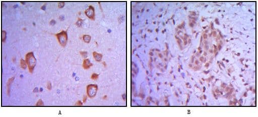 ETS1 / ETS-1 Antibody (clone 10D2)