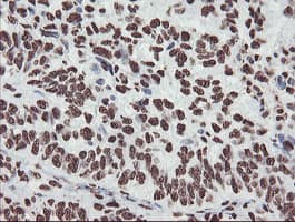 NONO / P54NRB Antibody (clone OTI2C9)
