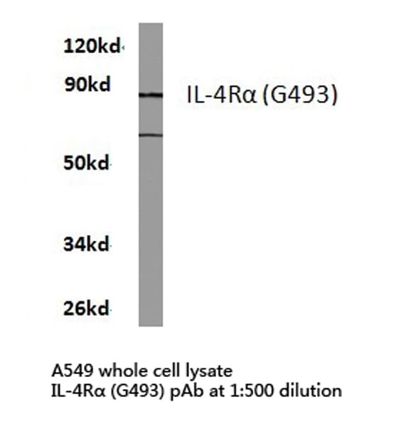 Polyclonal Rabbit anti-Human IL4R / CD124 Antibody (Gly493, IF, WB)