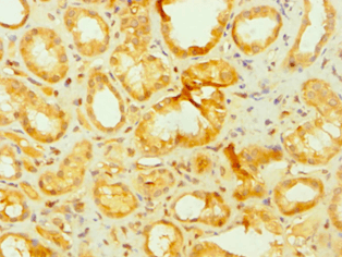 Polyclonal Rabbit anti-Human APLP2 Antibody (aa340-450, IHC)