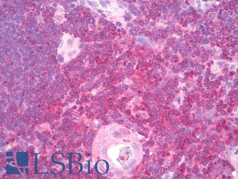IHC-plus™ Polyclonal Goat anti-Human PTPN6 / SHP1 Antibody (aa553-564, IHC, WB)