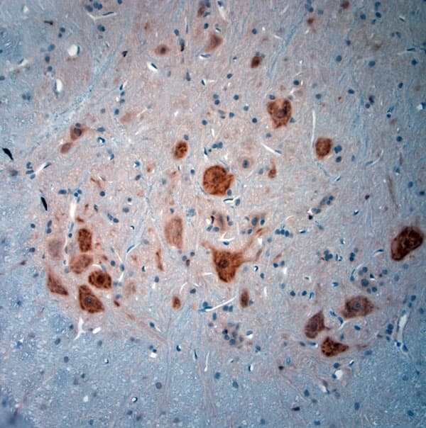 Polyclonal Rabbit anti-Human NeuN Antibody (aa80-130, IHC, WB)