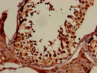 XPO1 / CRM1 Antibody
