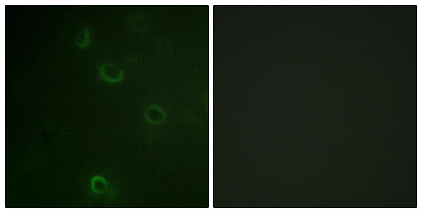 ATP1A1 Antibody (p16)