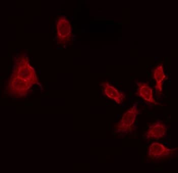 THAP4 Antibody