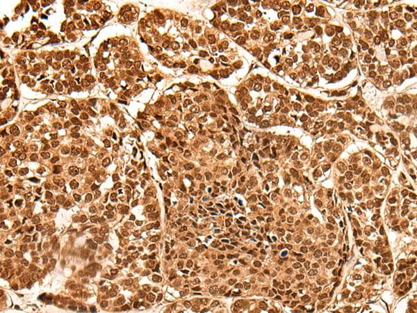 Polyclonal Rabbit anti-Human NEK7 Antibody (IHC)