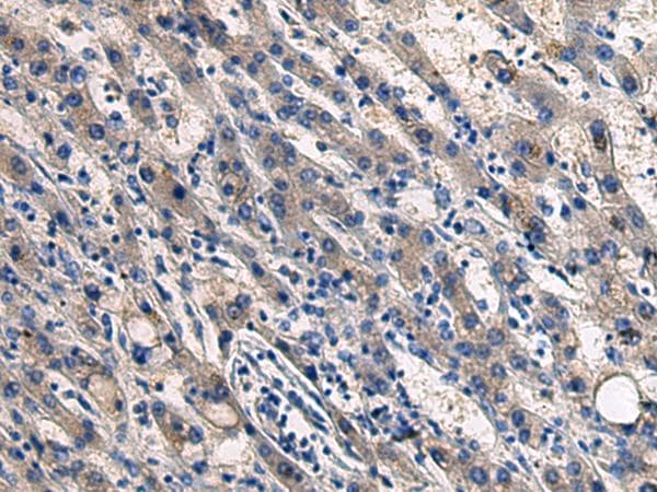 COL17A1 / Collagen XVII Antibody