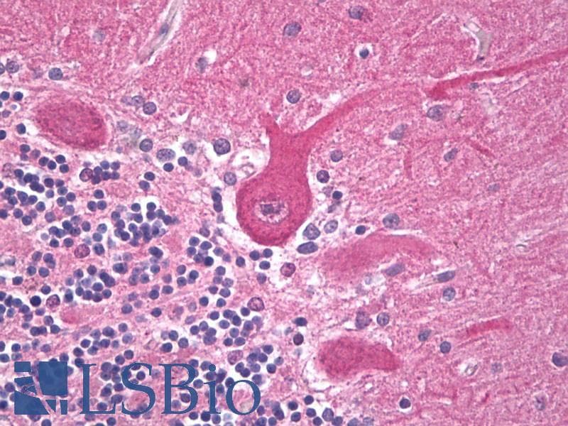 IHC-plus™ ANK2 / Ankyrin B Antibody