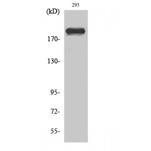 DATF1 / DIDO1 Antibody (130-210 aa, N-terminal)