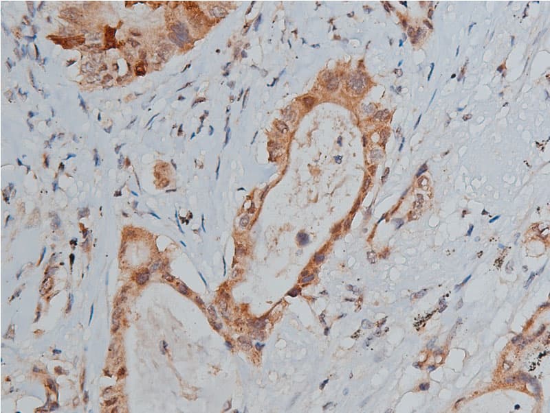 TP53 / p53 Antibody (phospho-Ser20)