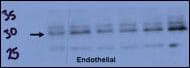 RCAN1 / DSCR1 Antibody (aa75-104)