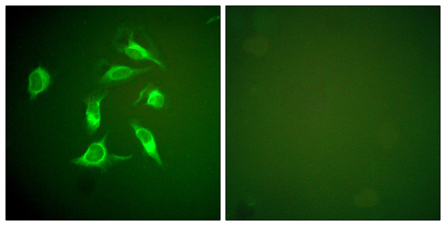 PDGFRA / PDGFR Alpha Antibody (aa1031-1080)