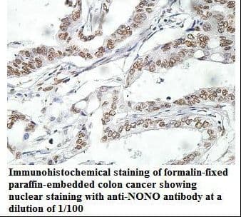 Polyclonal Rabbit anti-Human NONO / P54NRB Antibody (aa214-387, IHC, WB)