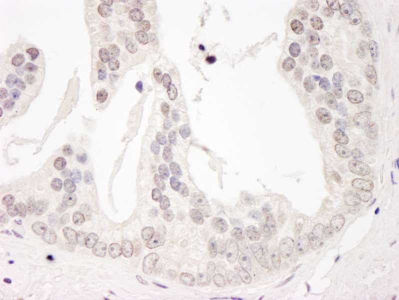 Polyclonal Rabbit anti-Human CCNL1 / Cyclin L1 Antibody (aa300-350, IHC, WB)