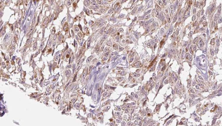 CRH / CRF Antibody