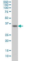 IHC-plus™ SPRY1 / Sprouty 1 Antibody (clone 3H4)