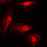 Polyclonal Rabbit anti-Human IRF4 Antibody (Internal, IHC, IF, WB)