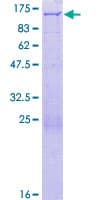 Human PEX6 Protein (Recombinant GST)