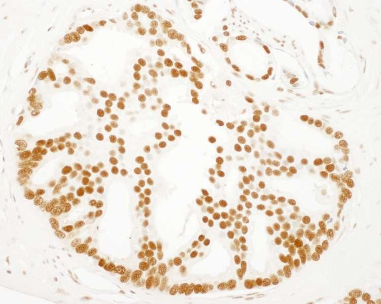 Polyclonal Rabbit anti-Human SET / TAF-I Antibody (aa125-175, IHC)