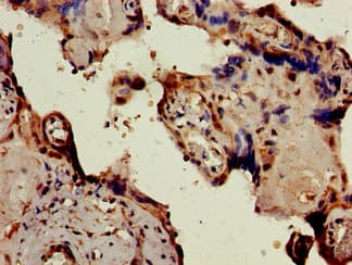Polyclonal Rabbit anti-Human PKIB Antibody (IHC, IF)
