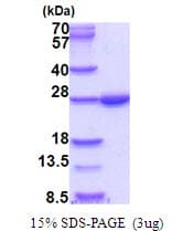 Human BNIP1 Protein (Recombinant His)