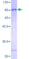 Human SLC39A5 / ZIP5 Protein (Recombinant GST)