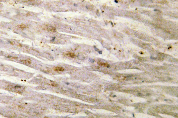 Polyclonal Rabbit anti-Human CEBPG / CEBP Gamma Antibody (Glu64, IHC, IF, WB)