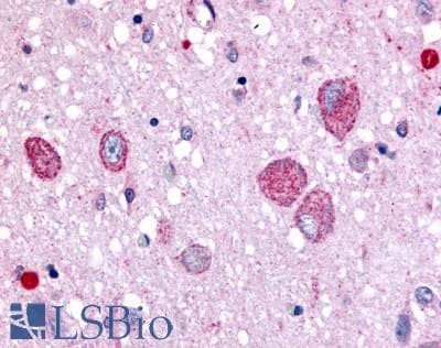 PathPlus™ CHRM2 / M2 Antibody (Cytoplasmic Domain)