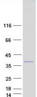 Human SCNM1 Protein (Recombinant Myc-DDK (Flag))
