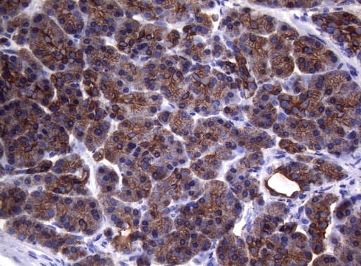 SYNC / SYNCOILIN Antibody (clone OTI5B8)