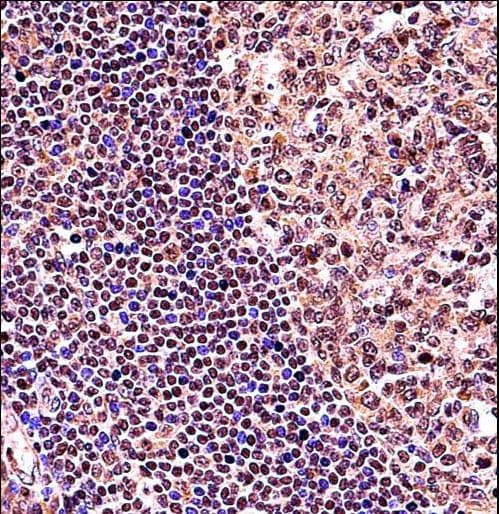 TCF3 / E2A Antibody (aa506-534)
