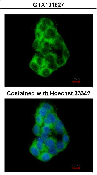 IHC-plus™ TANGO / MIA3 Antibody