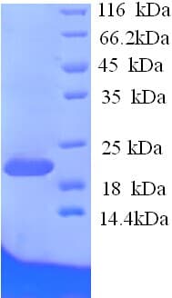 Rat EFNA1 / Ephrin A1 Protein (Recombinant His)