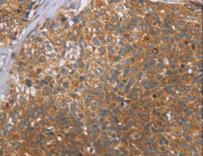 CCL21 / SLC Antibody