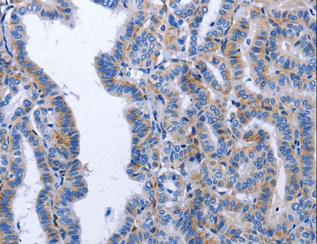 BDNF Antibody