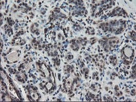TDO2 Antibody (clone OTI2A4)