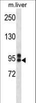 ABCC12 / MRP9 Antibody (aa723-752)