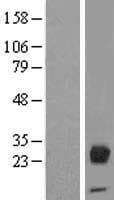 Human ORM2 / Orosomucoid 2 Protein (Over-Expression Lysate Myc-DDK (Flag))