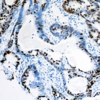 Polyclonal Rabbit anti-Human MSH3 Antibody (N-Terminus, IHC, WB)